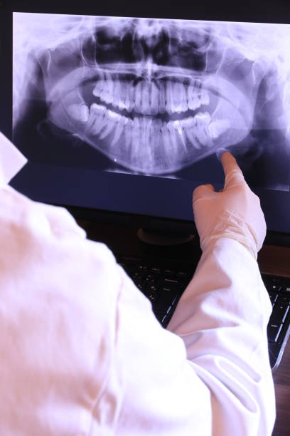 Best Emergency Root Canal Treatment in Lawton, OK